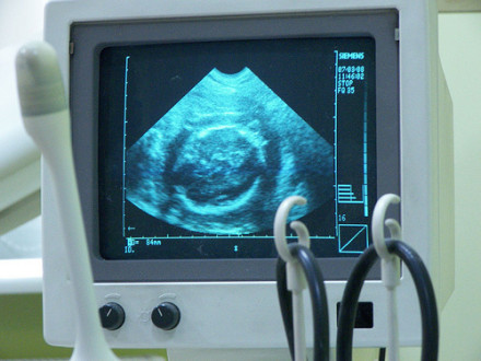 This sonogram might cost as much as your rent. (via flickr user Adam Piotrowski)