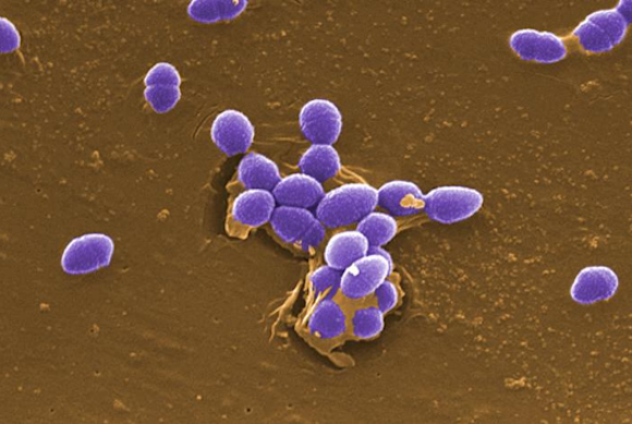 Meet your fellow commuter, urinary tract infection bacteria